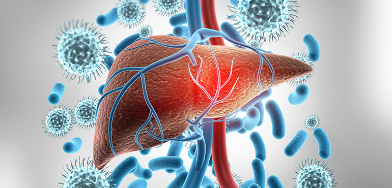 Qaraciyər patologiyaları: Hepatitlər və müalicəsi
